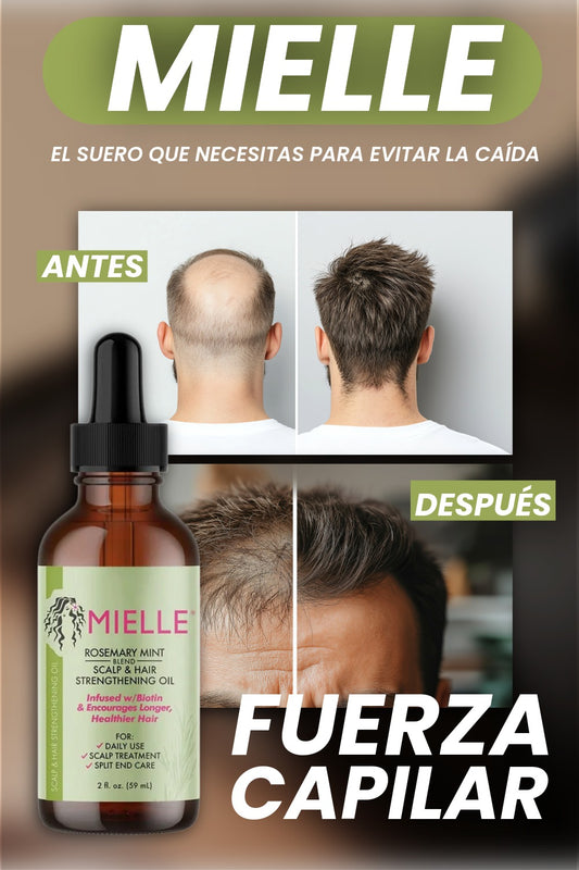 MIELLE-CAIDA DE CABELLO